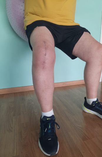 Rehabilitación postquirúrgica prótesis de rodilla